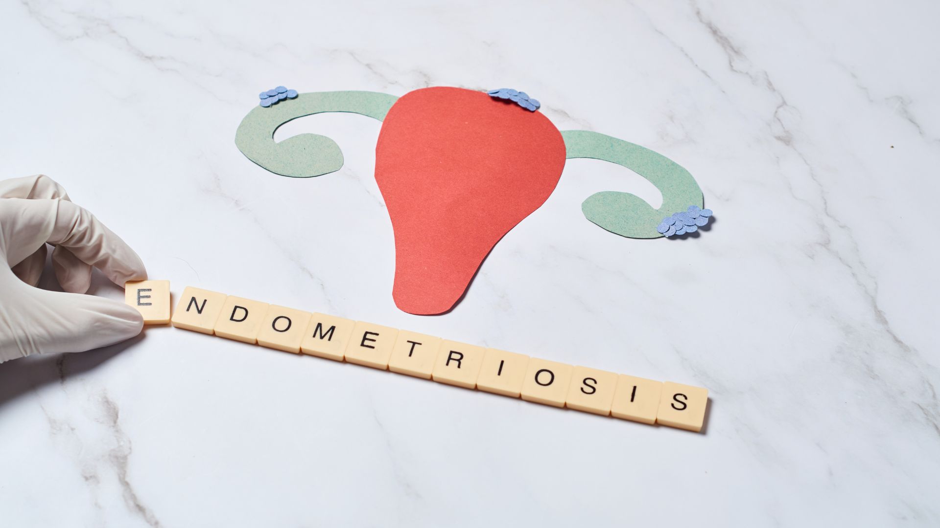 Tratamiento para la endometriosis